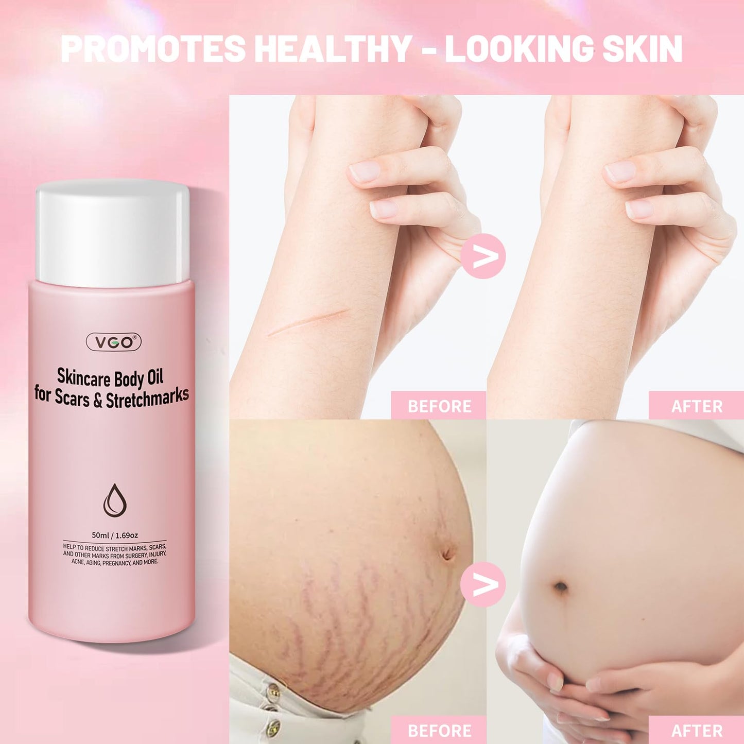 VGO Body Oil with Vitamin E, After Shower Body Oil For Smooth and Hydrated Skin, Non-Greasy & Fast Absorbing Lightweight Moisturizer for Scars & Stretch Marks, Hydrating for Dry Sensitive Skin