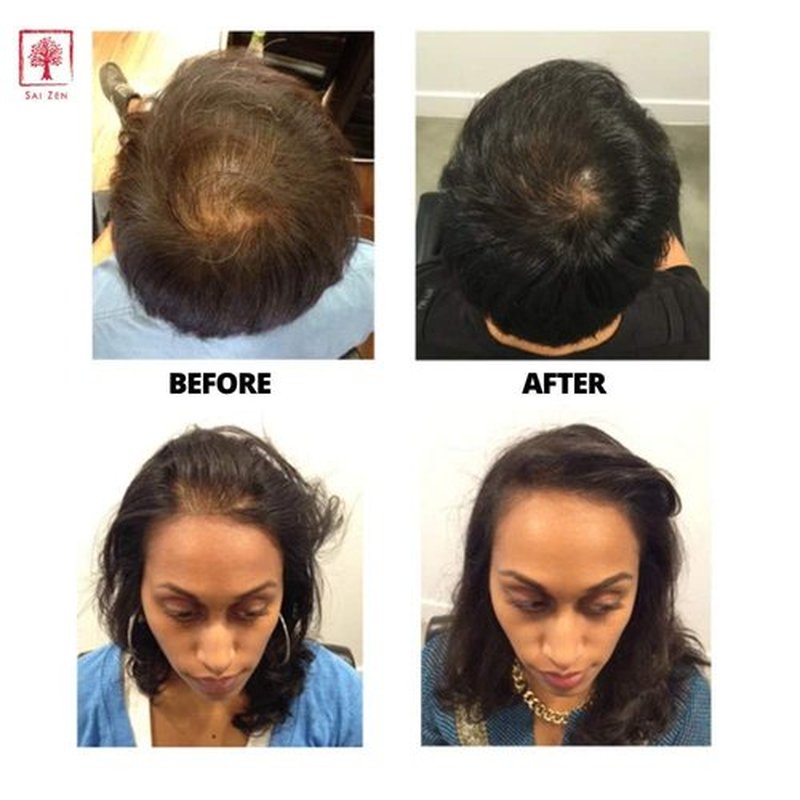 Sai Zen Volume Plus Set | Volumizing Shampoo 8 oz. & Scalp Therapy Spray 4 oz. | Anti-Thinning Formula | Made in USA | Sulfate, Alcohol & Paraben Free
