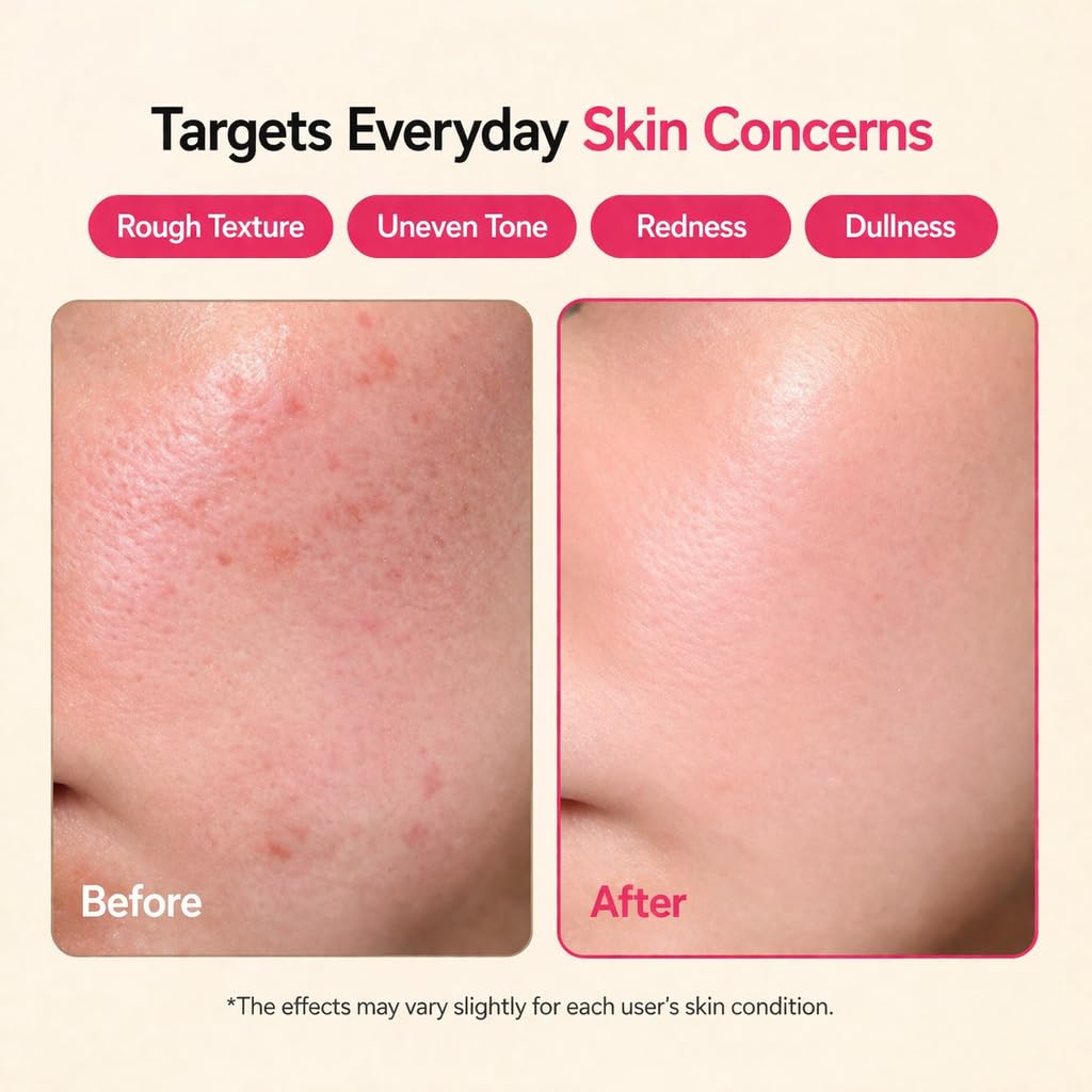 SFROMS Cica Toning Pink Serum with Vitamin B12 & Niacinamide-Brightening Hydrating Serum for Sensitive Skin, Dermatologically Tested, Fragrance-Free, Korean Skincare, 30 ml / 1.01 fl.oz
