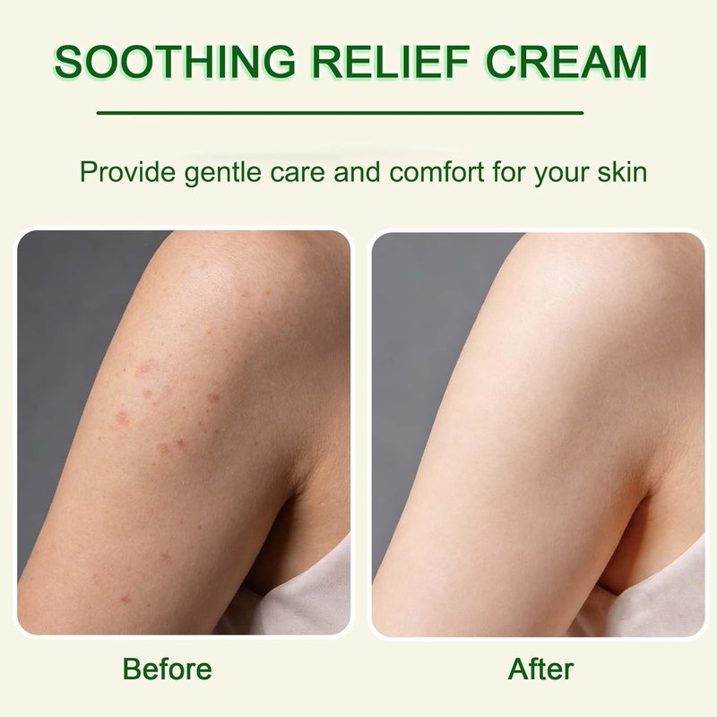 Soothing Moisture Cream for Sensitive & Dry Skin - Fragrance-Free Hydrating Lotion | 1.06 oz