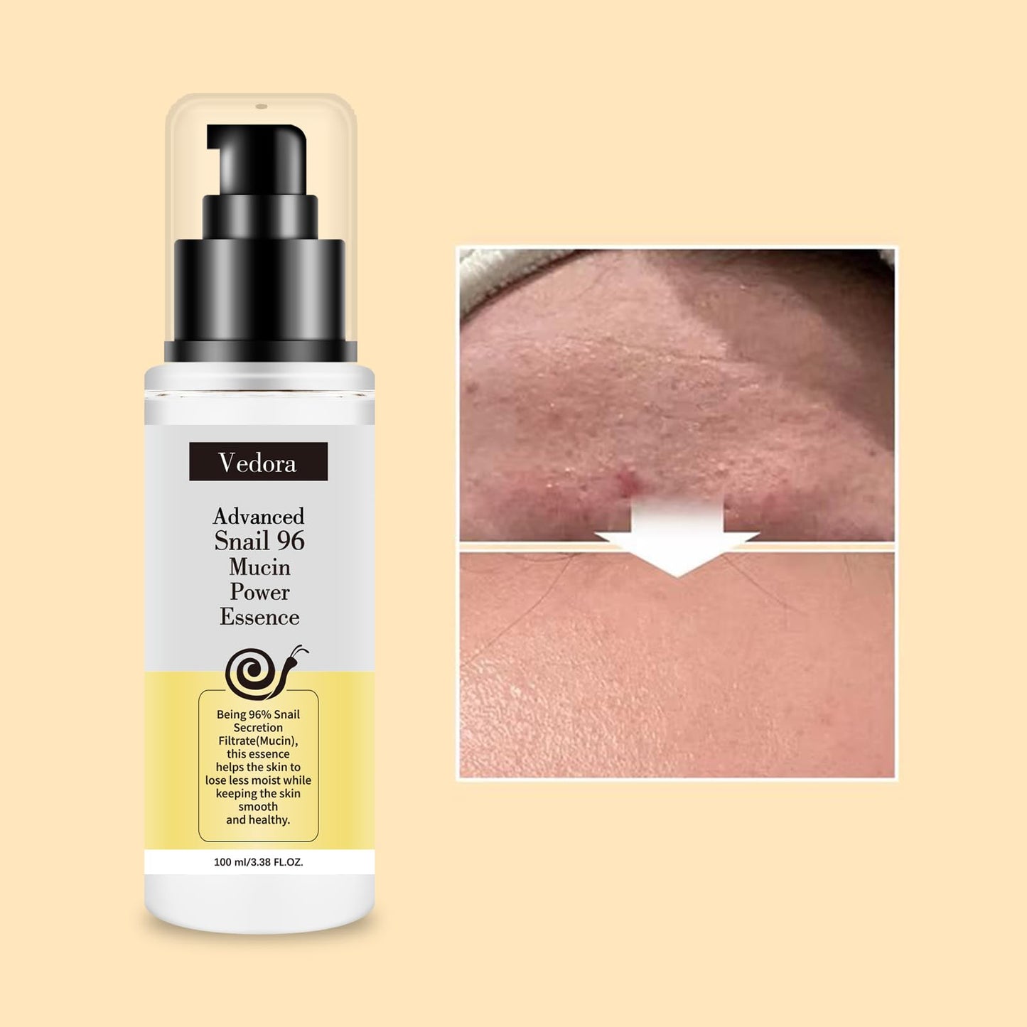 Vedora Snail Mucin 96% Power Hydrating Essence: Moisturizing Serum with Snail Secretion Filtrate for Radiant, Nourished Skin (3)
