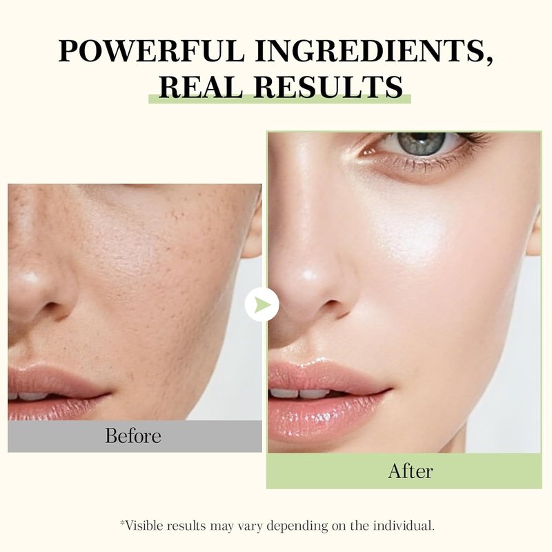 IREV 345 Relief Cream - Face Moisturizer for Soothing Blemishes | Vitamin C & Ceramides, All Skin Types