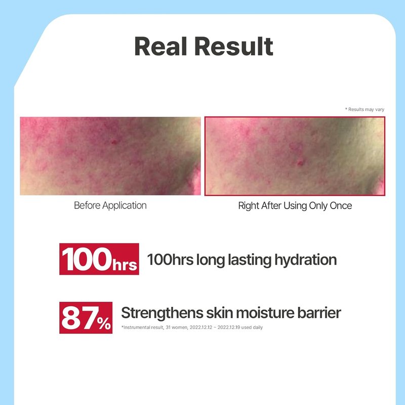 Illiyoon Ceramide Ato Lotion - Lightweight Moisturizer for Dry & Sensitive Skin | Vegan, 11.83 fl. oz.