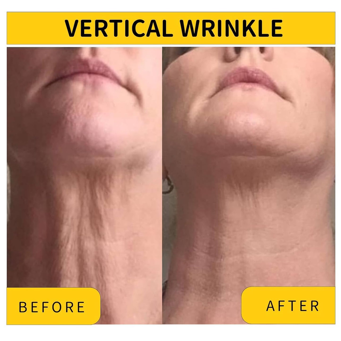 Irismistx Tighten and Lift Neck Firming Cream, Neck Creams for Tightening and Firming, Skin Tightening Cream for Face, Neck, Chest & Décolleté