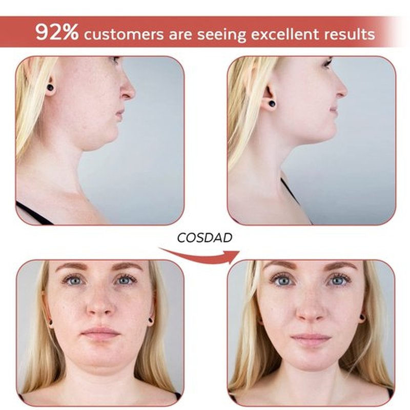 COSDAD Reusable Double Chin Reducer Chin Strap - V Line Lifting Mask for Women, with Innovative Lifting Technology, Breathable and Comfortable, One Fits All