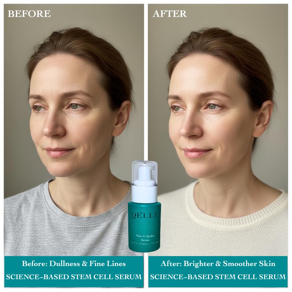 Organic Elle Serum Vitamin C Hydra Glow, with Hyaluronic Acid, Ferulic Acid, MSM & Stem Cells – Brightening, Hydrating, Dark Spot & Fine Line Support, Lightweight Anti-Aging Face Serum
