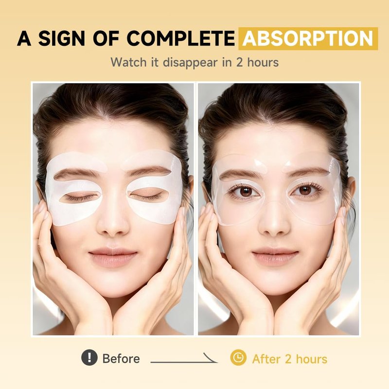 5% PDRN Under Eye Patches - 6-in-1 Bio-Collagen Eye Mask for Puffiness, Dark Circles & Wrinkles | 2% Caffeine, Kojic Acid, Retinol