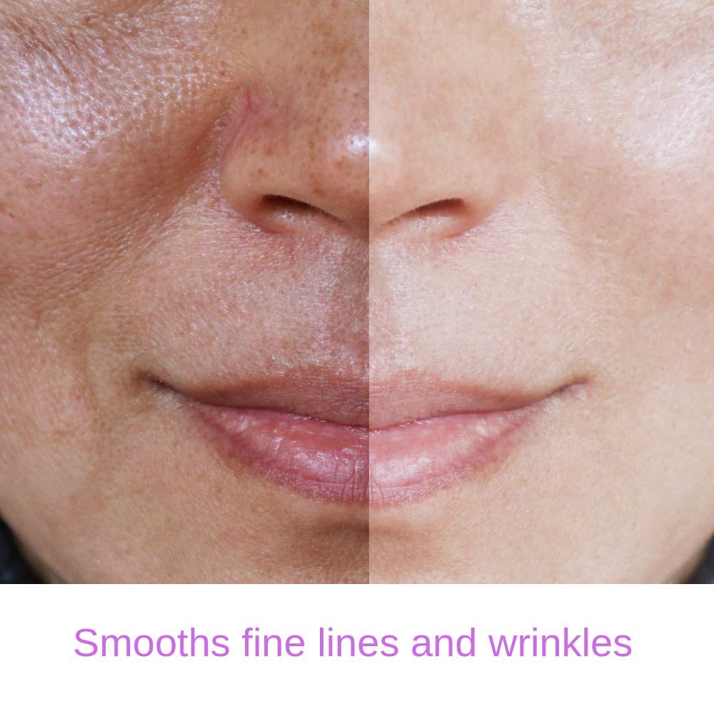 Essence of Arcadia RETINOL Serum 2.5% Professional Anti- Aging Formula With hydrating Hyaluronic Acid and Vitamin E, Minimize Wrinkles