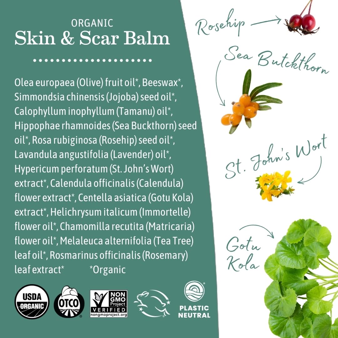 Earth Mama Organic Skin & Scar Balm |C-Section Recovery Skin Care, Pregnancy Stretch Mark Scar Cream with Organic Jojoba Oil, Tamanu Oil & Gotu Kola