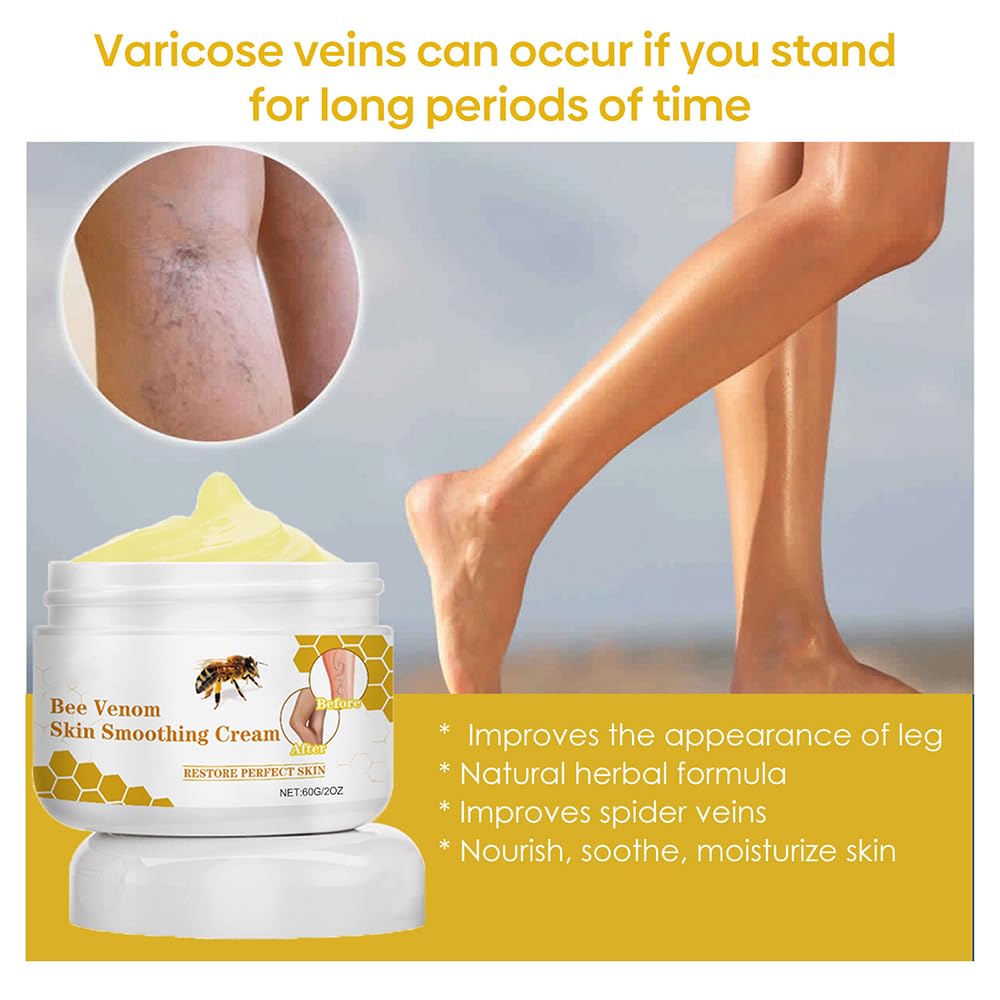 etitek 2PCS Bee Venom Varicose Veins Cream for Legs，Moisturizing Leg Creams Natural Ingredient Leg Care 4oz/120g
