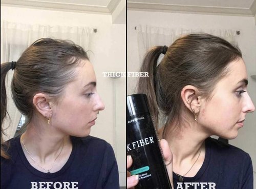 THICK FIBER Hair Fibers For Thinning Hair & Bald Spots (MEDIUM BROWN, Pack of 2) - 25g Bottle - Conceals Hair Loss in Seconds - Hair Powder For Women & Men
