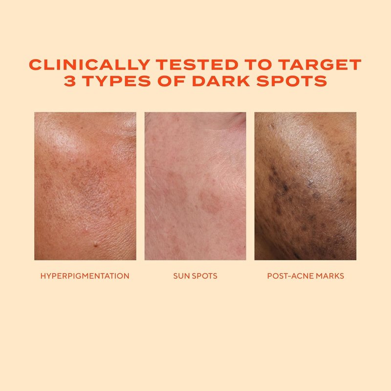 Murad Bright Eyed & Spotless Combo - Retinol Eye & Dark Spot Serums for Discoloration & Fine Lines | Set of 2