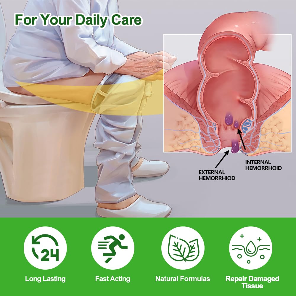 RHAICARE Hemorrhoid and Fissure Cream,Hemorrhoidal Ointment for Fast Acting Itch, Swelling, and Maximum Strength Pain Relief（1 Pack