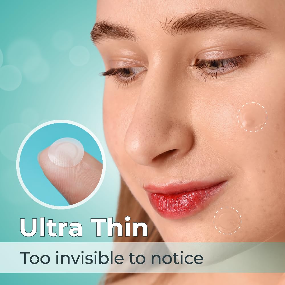 Cornice 144 Count Hydrocolloid Skin Cover Patches – Ultra-Thin, Waterproof & Sweat-Resistant – Multi-Size Protective Skin Patches for Teens & Adults
