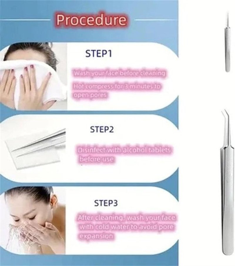 Usiveinborn Blackhead Remover, Usiveinborn Tweezers, Professional Facial Blackhead Remover Tweezers, Blackhead Remover Comedone Extractor (Hook-Mouth clamp)