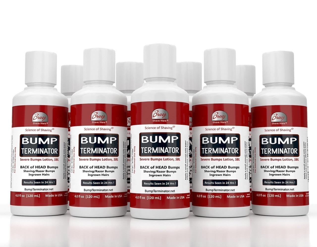 BUMP TERMINATOR Severe Bumps Treatment | Razor Bumps And Ingrown Hair Treatment | Bikini Bumps | Back of Head Bumps And Ingrown Hair Treatment, 4 oz (Pack of 1)