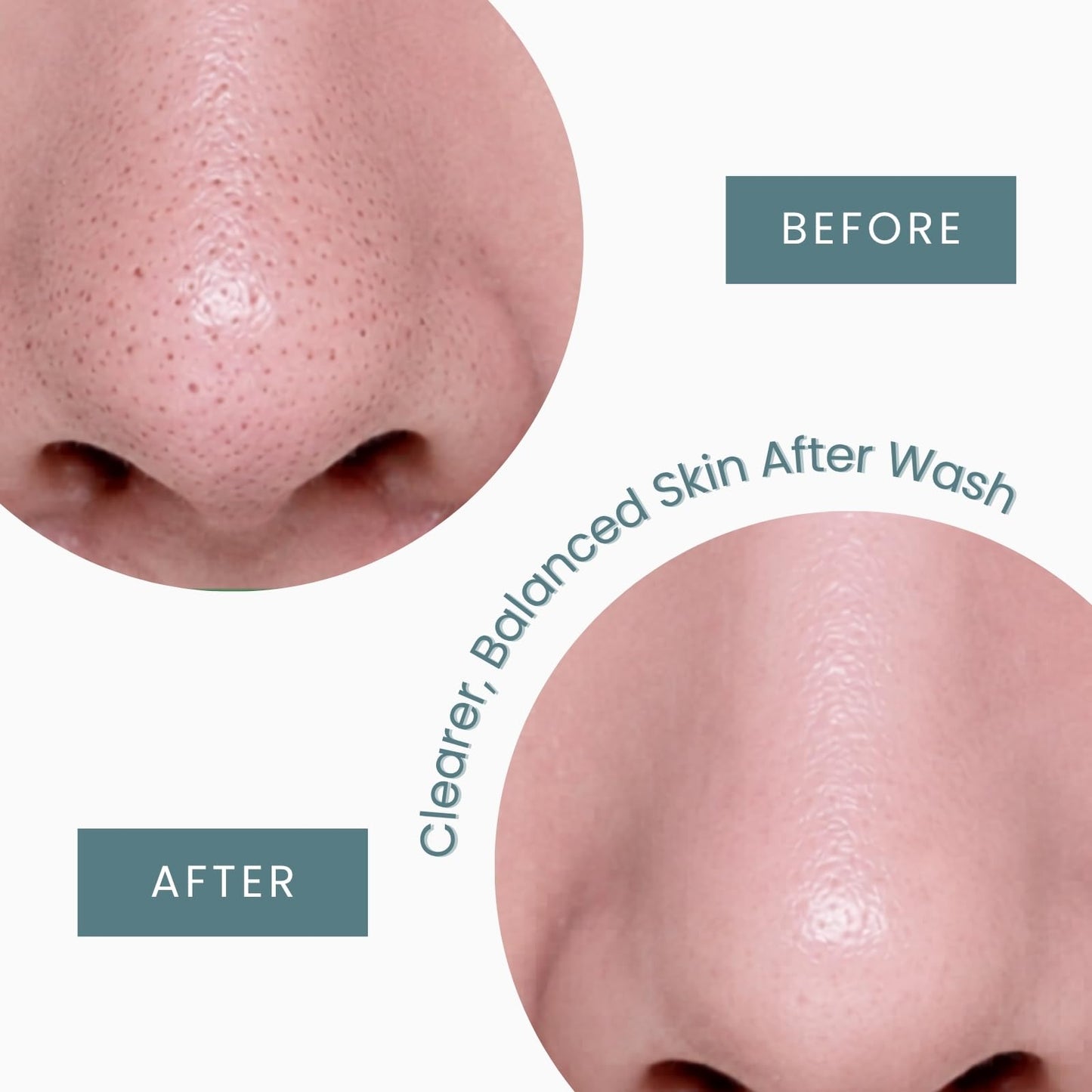 CONSLY Charcoal Face Wash – Pore Cleanser for Oily & Combination Skin, Helps Reduce Blackhead Appearance, Oil Control, Gentle Exfoliating Foam, Korean Skincare 100ml