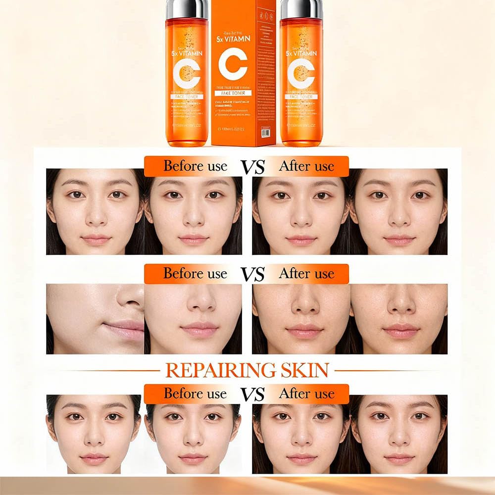 5X Vitamin C Toner, Hyaluronic Acid Facial, Suitable for Face, Arms, and Legs, Natural Ingredients, Powerfully Moisturizing, Face for Sensitive Skin (Face Vitamin C Toner for Women Anti Aging)