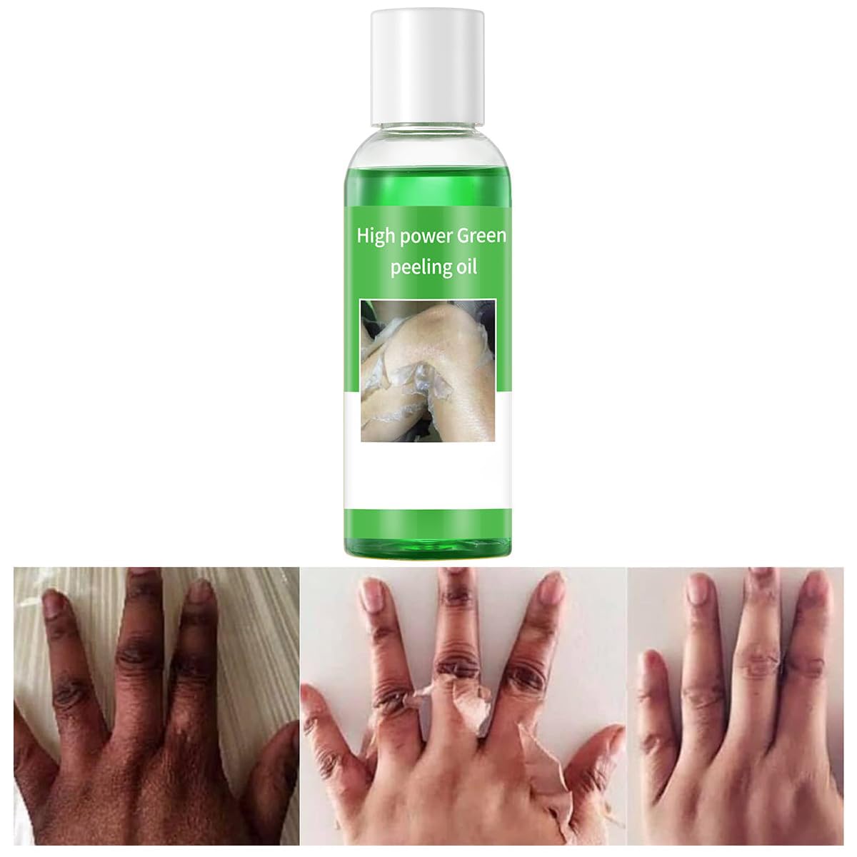 IREV Peeling Oil for Dark Skin, Green Peeling Oil, Facial Peels with Hyaluronate,Exfoliating Peel Solution for Body, Chemical Peel At Home for Dark Spots, Body Exfoliant Peels 3.66 OZ