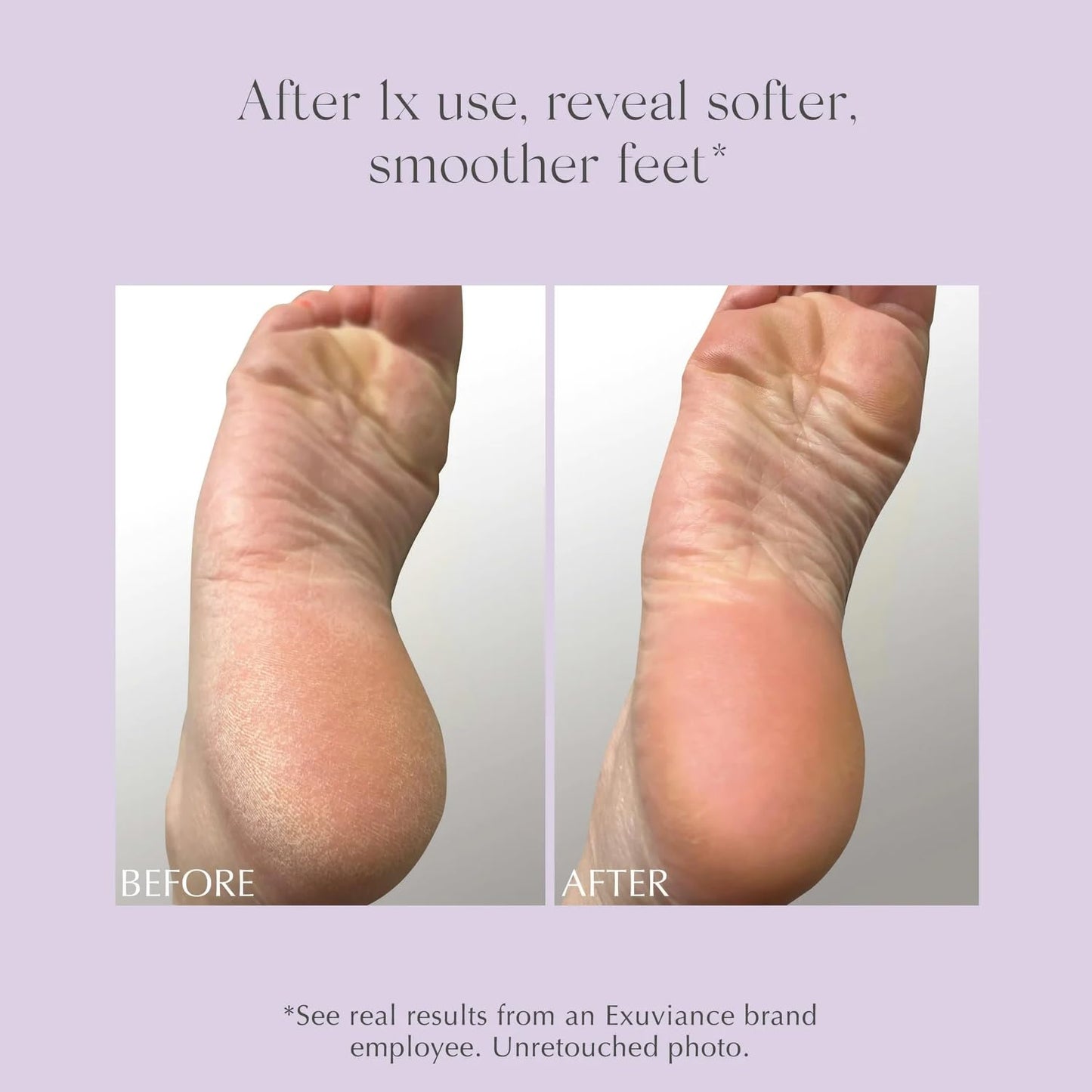 EXUVIANCE Exfoliating & Conditioning Foot Balm, 1.7 oz