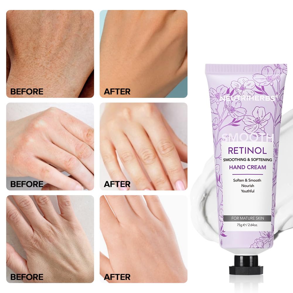 Neutriherbs Retinol Hand Cream, Lightweight Anti-Aging Hand Moisturizer for Hand Wrinkles. Soften Smooth Nourish Hand, Protect Skin, Nails, Cuticles with Green Bamboo Scent - 2.64oz
