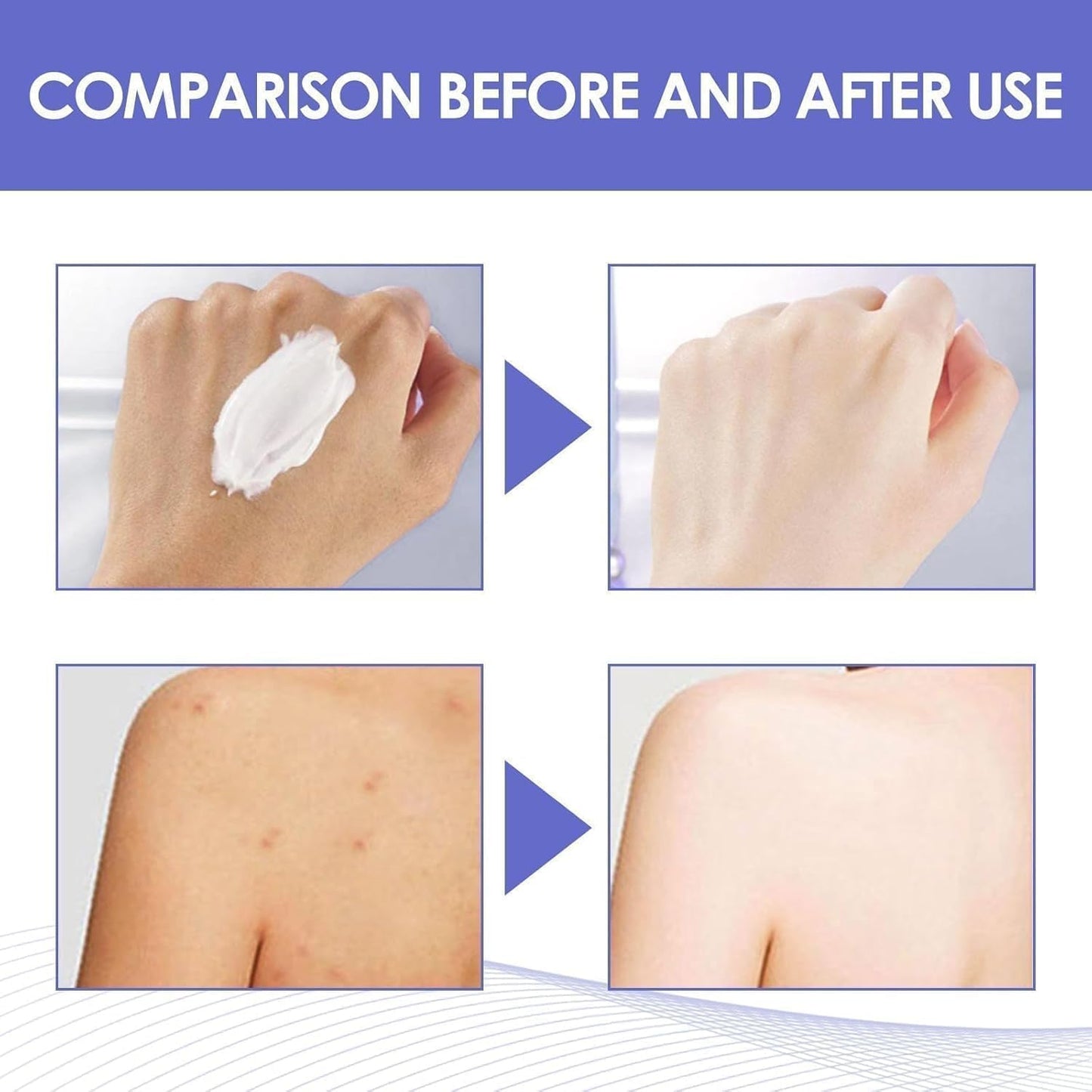 Dark Elbow and Knees Remover, Skin Brightening Cream for Dark Inner Thigh