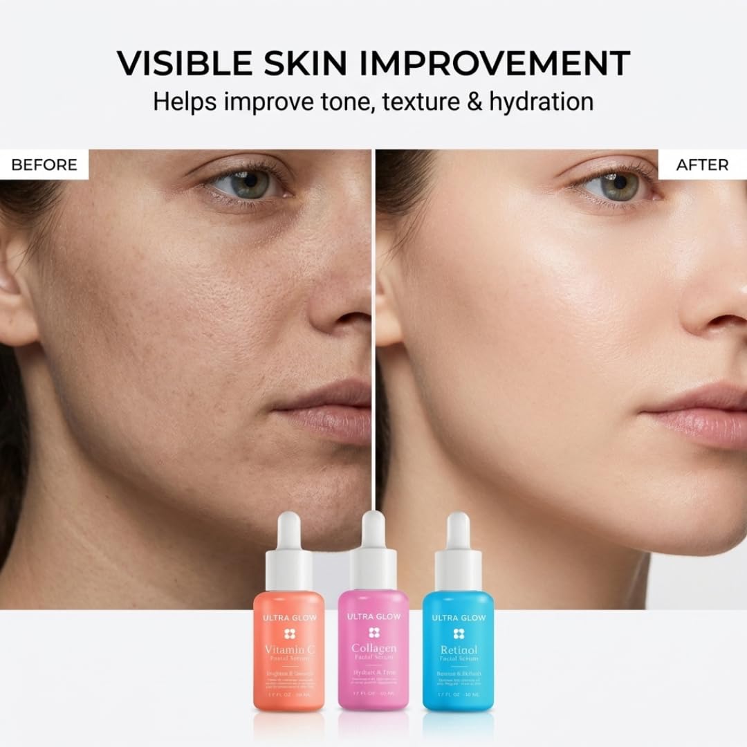 My Beauty Spot 3 Pack Facial Serums – Vitamin C Serum, Collagen & Retinol Serum for Face, Brightening & Anti Aging Face Serum for Women, Dark Spot Corrector, Hydrating Skin Care Set
