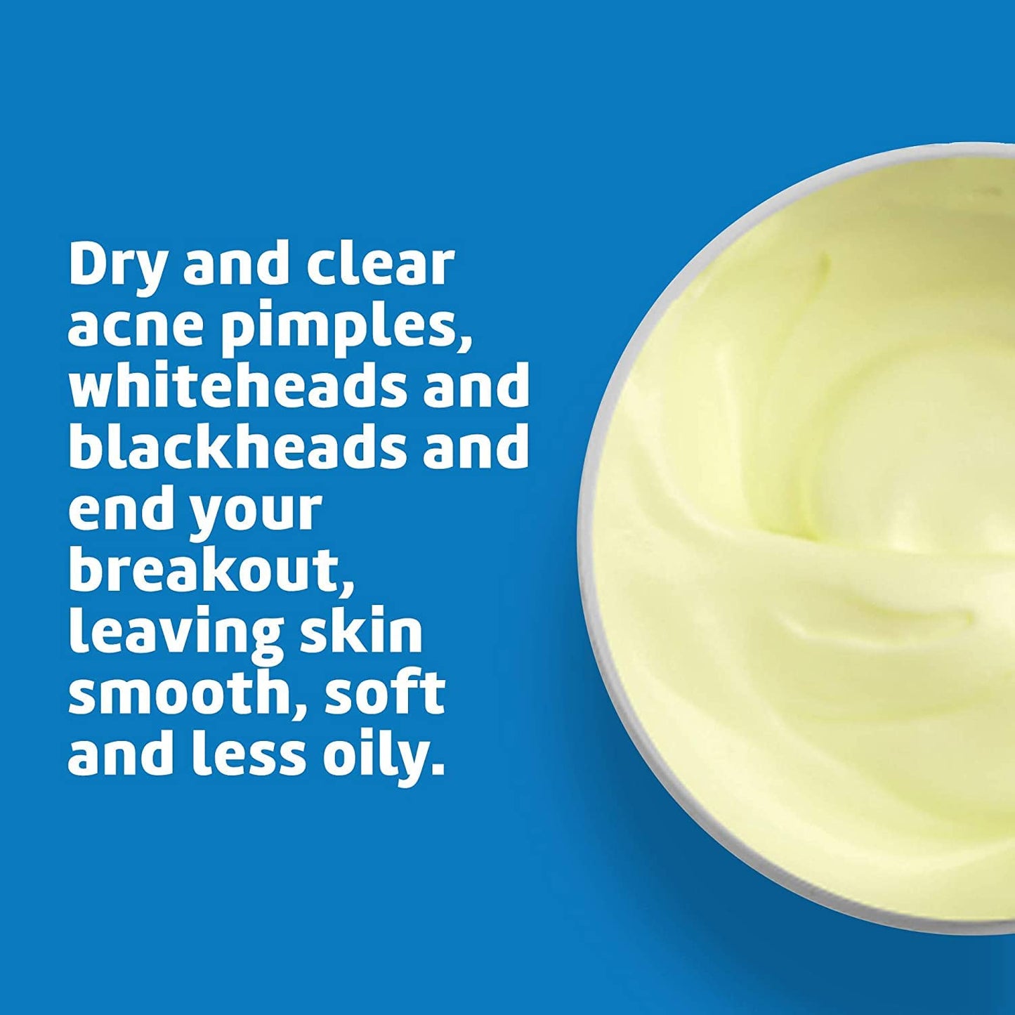 De La Cruz 10% Sulfur Ointment Cystic Acne Spot Treatment for Face & Body Skin Care Face Mask & Blackhead Remover, Treatment for Hormonal Acne 2.6 oz, 2 Pack