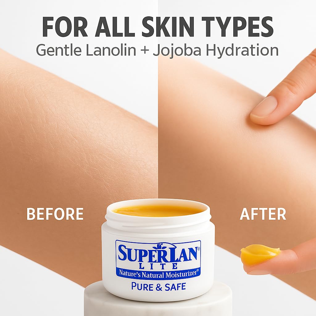 superlan Moisturizer Lanolin Cream 4 oz with Jojoba Oil for Hot, Dry & Cold Weather - Lightweight Creamy Formula with Medical-Grade Lanolin & Jojoba Oil - Moisturizer for Hands, Feet, Body, and More