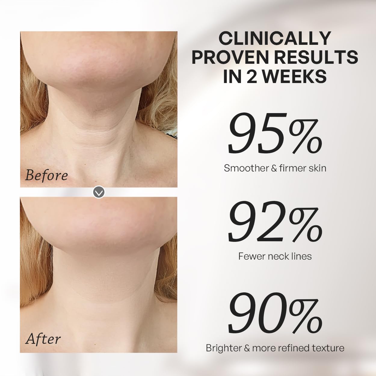 TRUU PDRN ExoRegenPro+™ Anti-Wrinkle Firming Neck Cream - Powered by 10,000ppm PDRN, 100 billion Exosomes, and 0.3% Retinol - Moisturizing, Smooths Fine Lines & Firms Skin | 1.76Oz