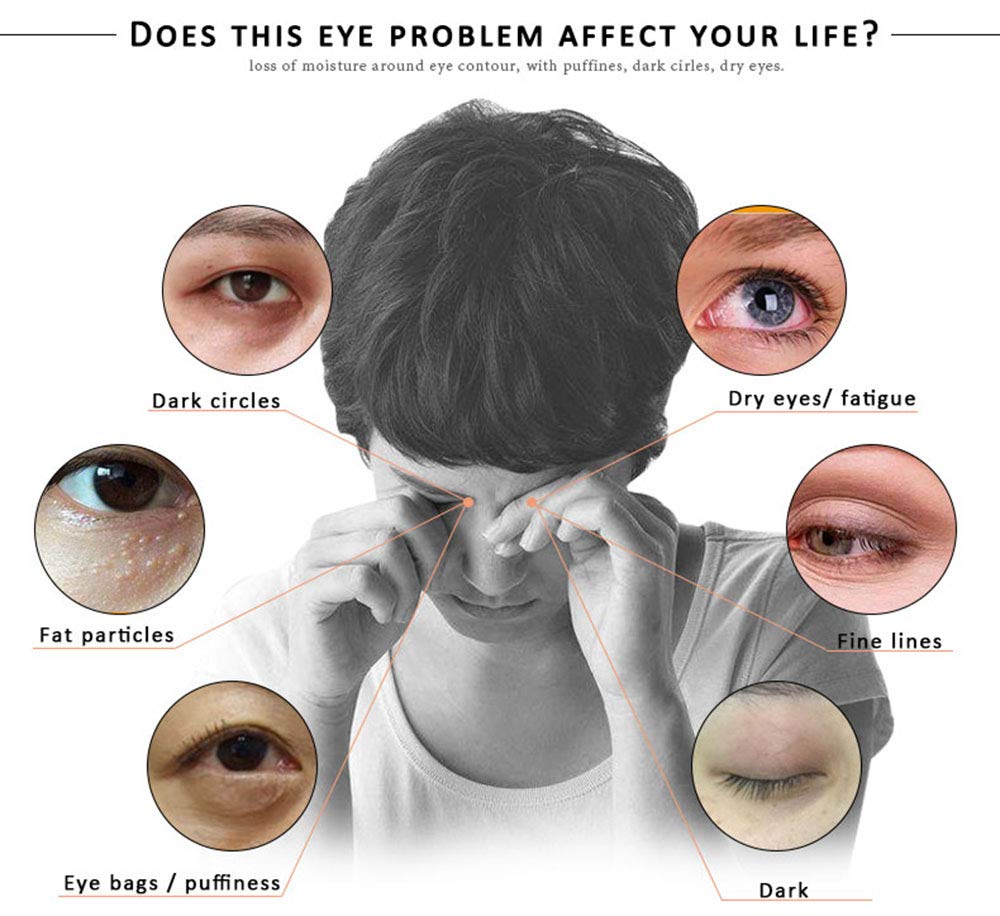 MIESCHER Eye Peptide Serum Massage Roller Nourishing Relieve Loose Eye Bags Dark Circles Skin Care Under Eye Cream for Fine Wrinkles and Puffiness Daily Skincare(Nourishing Grey)