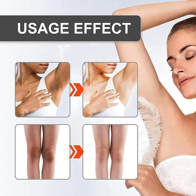 Intimate Skin Brightening Cream - Underarm & Bikini Area Lightener | 30ML/1.0 FL.Oz