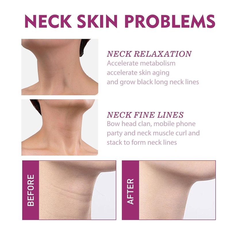 Hydrolized Collagen Neck Cream - Firming & Tightening Anti-Aging Formula for Sagging Skin | 1 oz