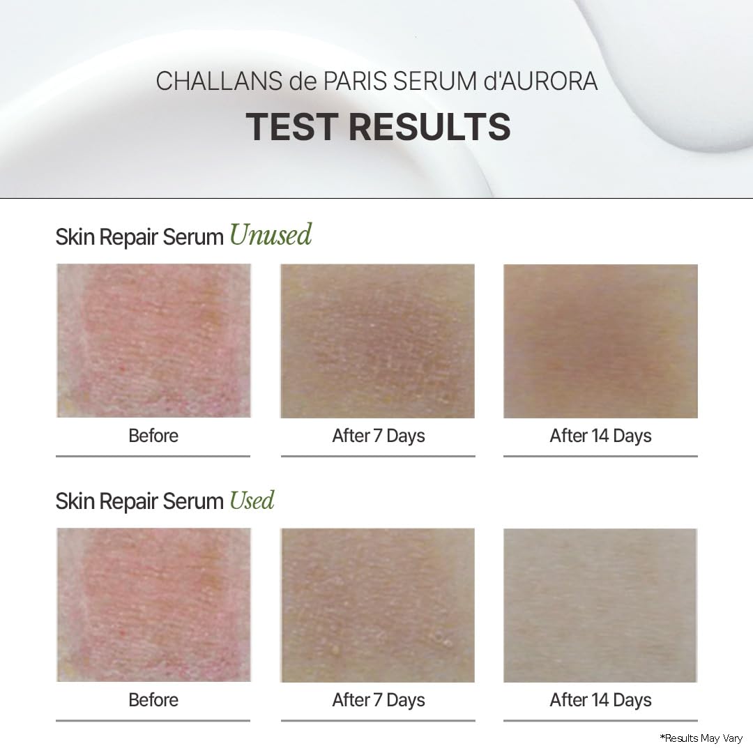 [CHALLANS de PARIS] Ampoule d’Aurora Excellence – Soothing & Balancing Skin-Barrier Support Serum with Niacinamide, Oligo-HA & Ceramide | Lightweight Watery, Hydrating Korean Skincare, 1.23 fl oz