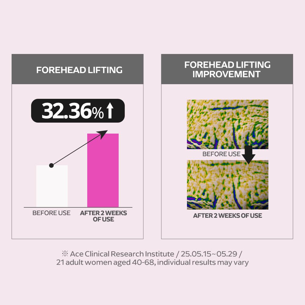 EUNYUL Ring Collagen 20% Face Serum (1.18 fl.oz / 35ml) – Korean Collagen Serum with 200,000ppm Collagen, Peptides & Niacinamide, Hydrating & Firming Skin Care
