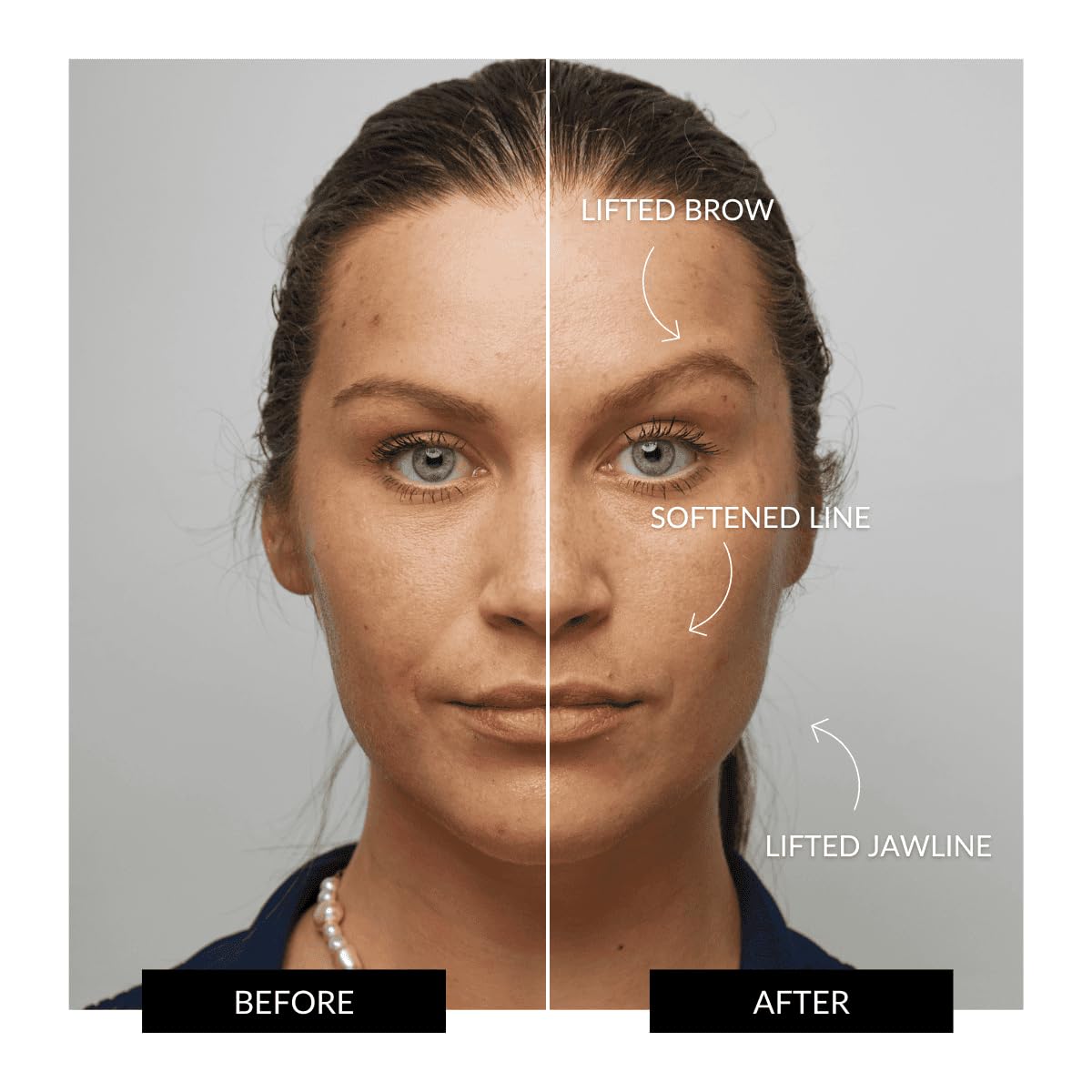 ZIIP Halo Facial Toning Device | Microcurrent and Nanocurrent Facial Device | Strengthening and Sculpting for Youthful, Glowing Skin | Anti-Aging at Home Use to Sculpt, Lift and Contour The Face