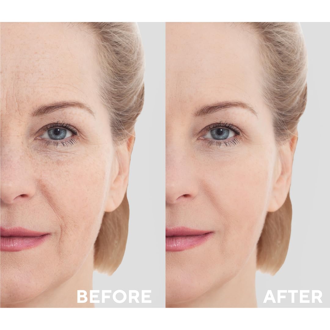 The Ceel Retinol Serum for Face | Resurfacing Retinol Serum | Firming, Anti aging, Brightening | Smoothing Fine Lines and Wrinkles | Retinol 1%, Ceramides and Niacinamide|1 fl.oz(30 ML)