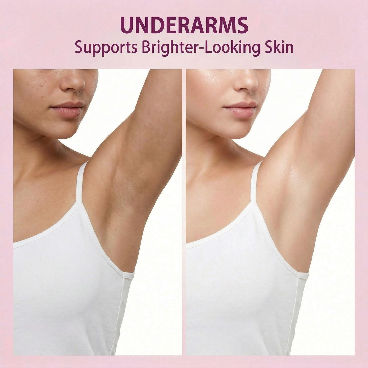 Dark Spot Remover for Body, Body Brightening Cream with Niacinamide, Tranexamic Acid & Hyaluronic Acid, Helps Improve Uneven Tone on Knees, Elbows, Underarms, Bikini Area & Inner Thighs, 1.76 Fl Oz