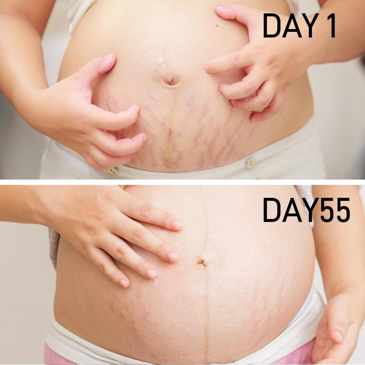 Stretch Mark Cream for Pregnancy & Postpartum,with Argan Oil, Shea Butter & Vitamin E,Stretch Mark Prevention for Belly,Moisturize Skin,Prevent & Fade stretch marks (100ml_1PACK)