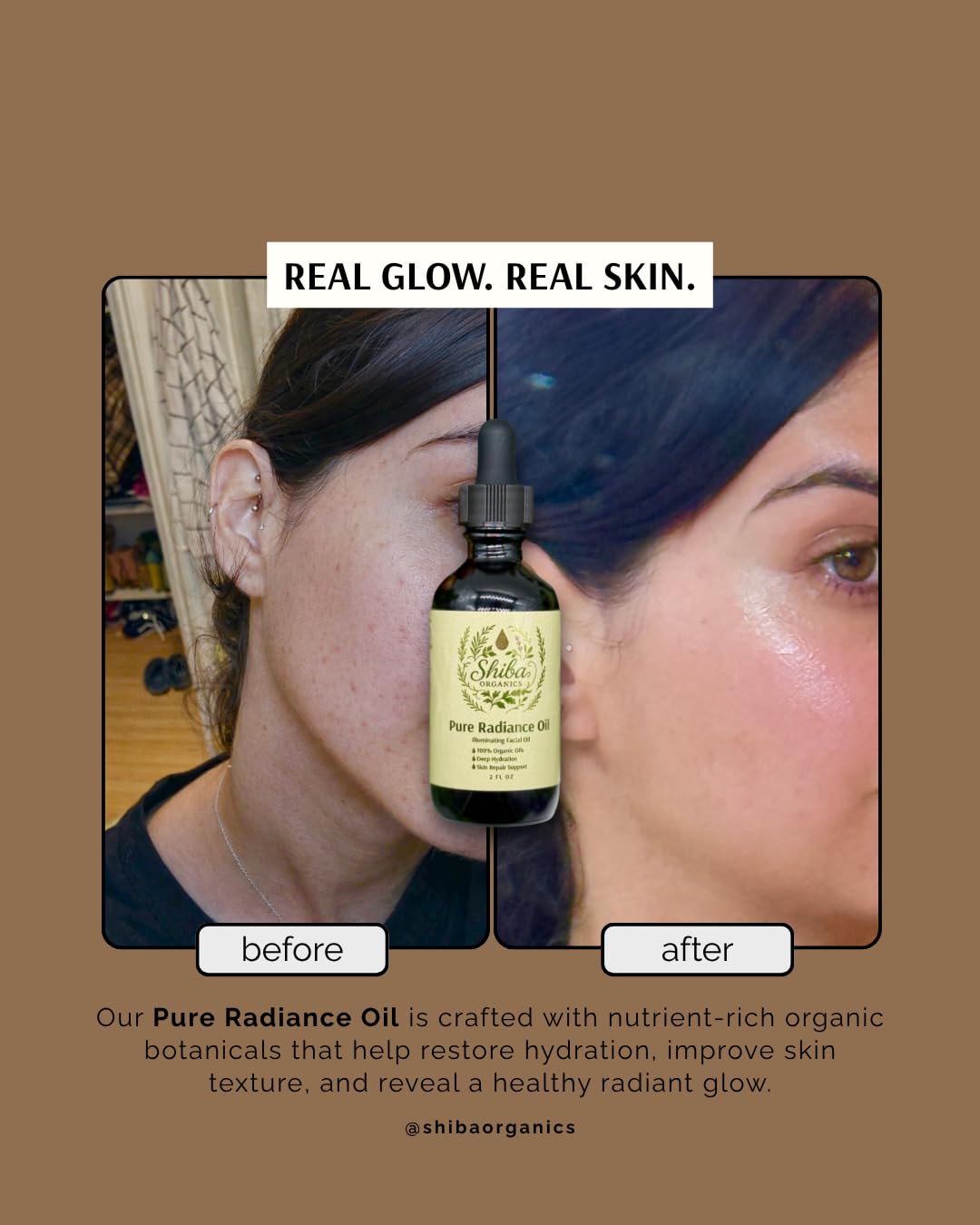 Shiba Organics Pure Radiance Oil - Face Oil for Glowing Skin, Hydrating Facial Oil with Rosehip, Jojoba & Pomegranate. Lightweight Botanical Face Oil for Dry, Dull Skin - Natural Glow Oil Moisturizer