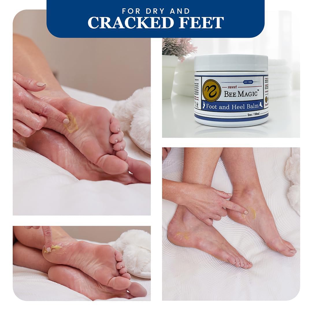 Sweet Bee Naturals Organic Foot Balm - Intensive Heel Balm for Dry Cracked Feet - Natural Moisturizing Treatment for Cracked Heels - Heel Cream Softener for Rough Skin Repair 2 Jars (4 OZ)