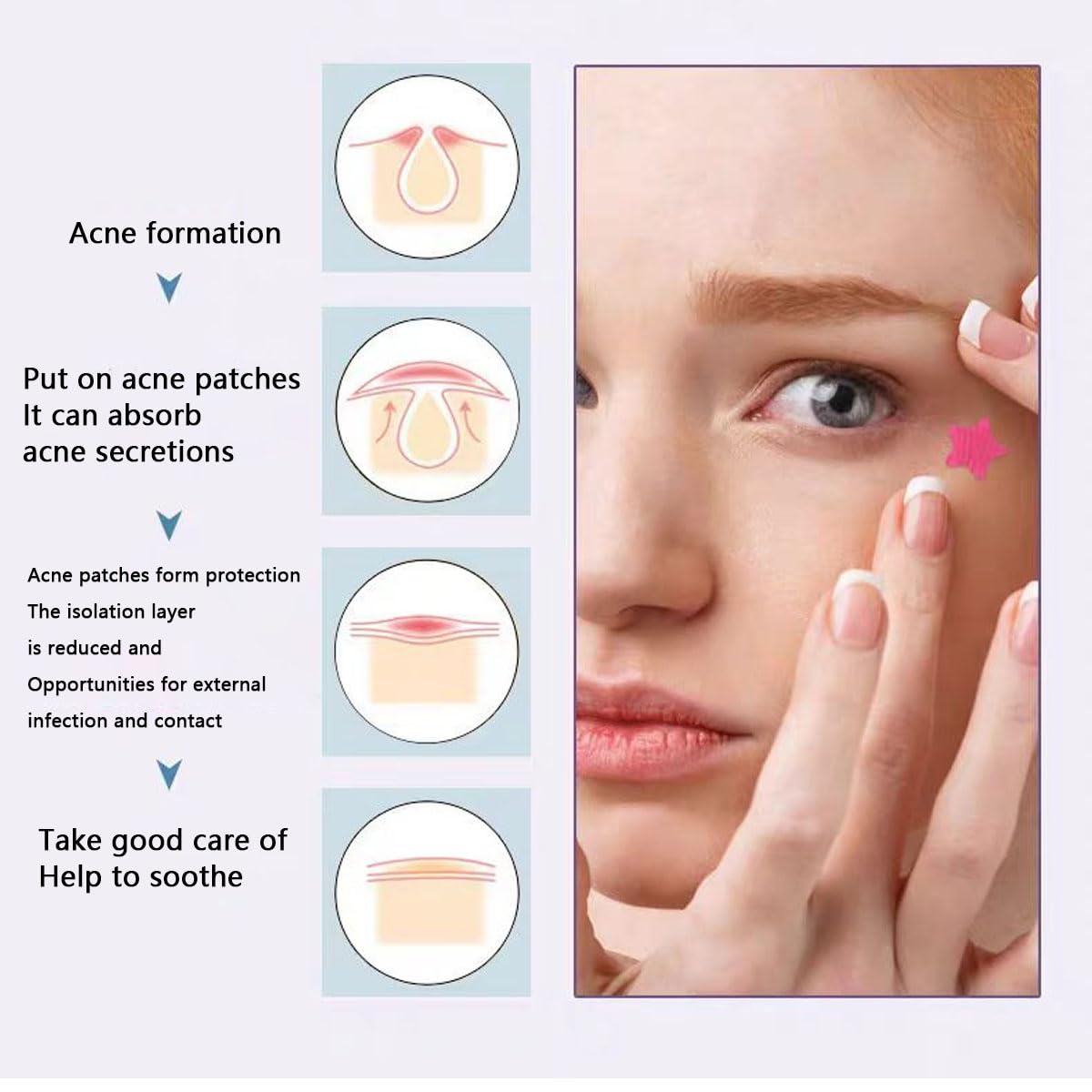 Pimple Patches for Face, 153 pcs Acne Patches, Cute Zit Covers for Face, Spot Stickers with Tea essential oil ， Salicylic Acid and Cica Oil