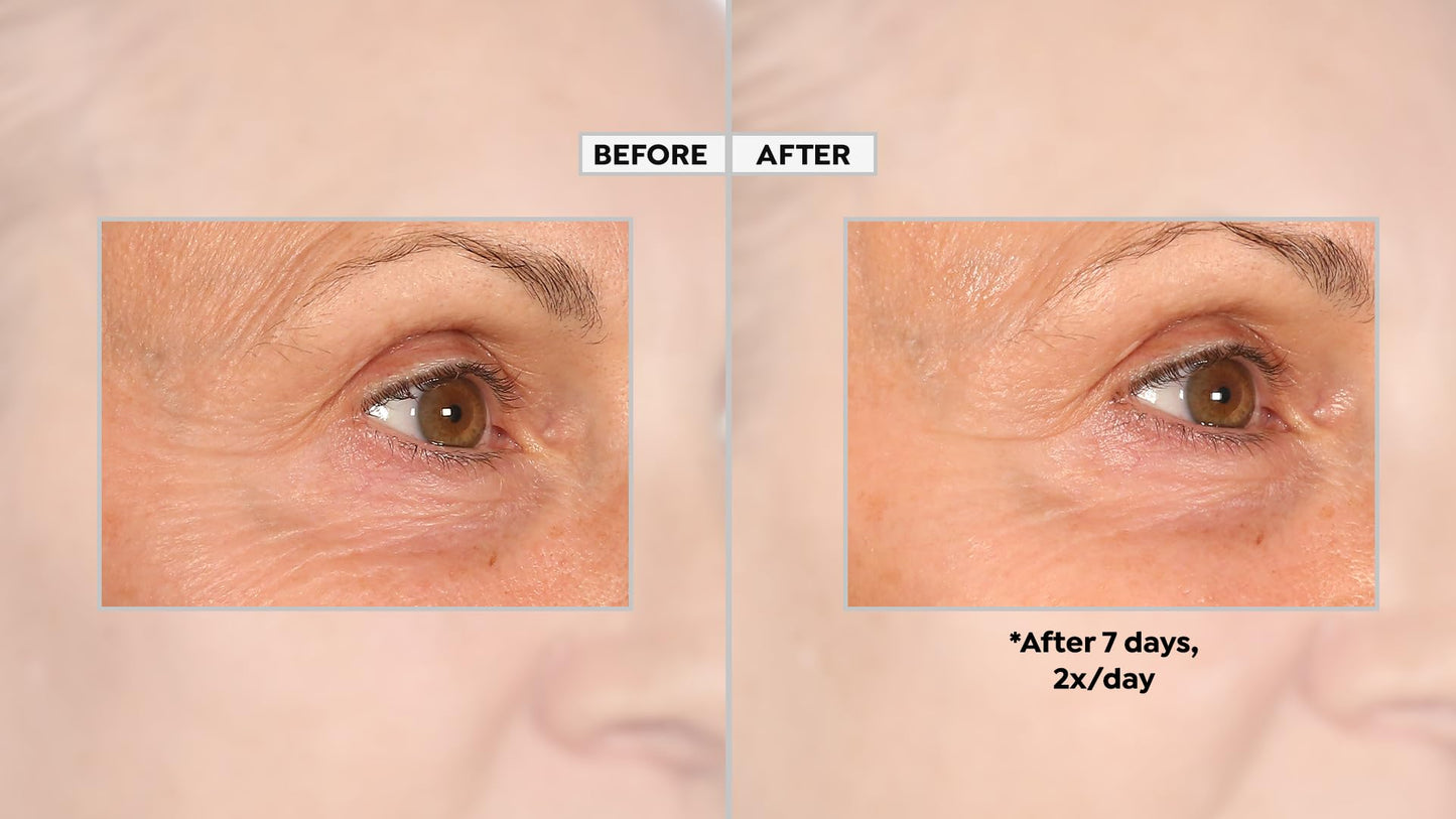 PRAI Beauty - Ageless Eye Advanced Eye Serum 0.5 oz