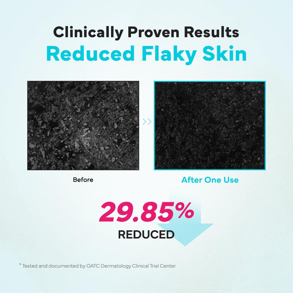 SAM'U Galacto Pore Chewy Powder Wash, Pore Enzyme Cleanser, 1.76 oz