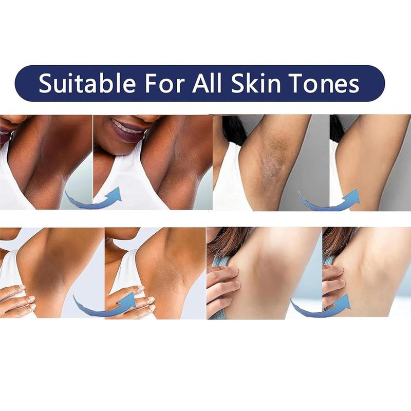 Skin Lightening Cream Gel - Niacinamide & Vitamin C for Body & Intimate Areas | 30ML