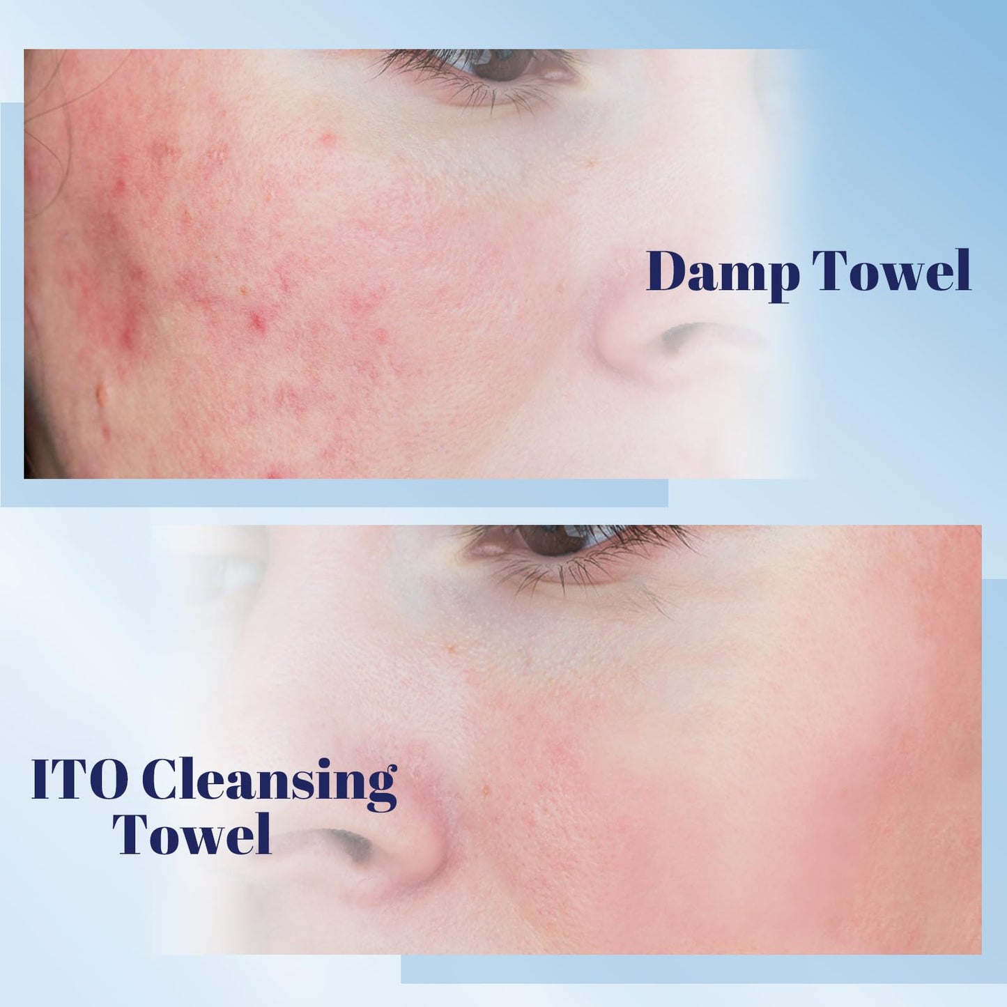ITO Disposable Face Towel, Ultra-Soft 1-Second Quick-Dry Face Towels, Gentle for Sensitive Dry Oily Skin, Facial Towels for Daily Cleansing Makeup Removal (70 Count (Pack of 1))