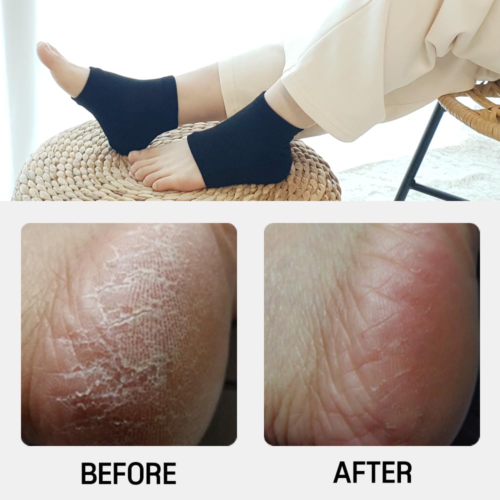 Moisturizing Gel Heel Socks to Repair Dry Cracked Heel - Soften, Soothe, and Revitalize Your Feet, for Men and Women (Black, 2 Pairs)
