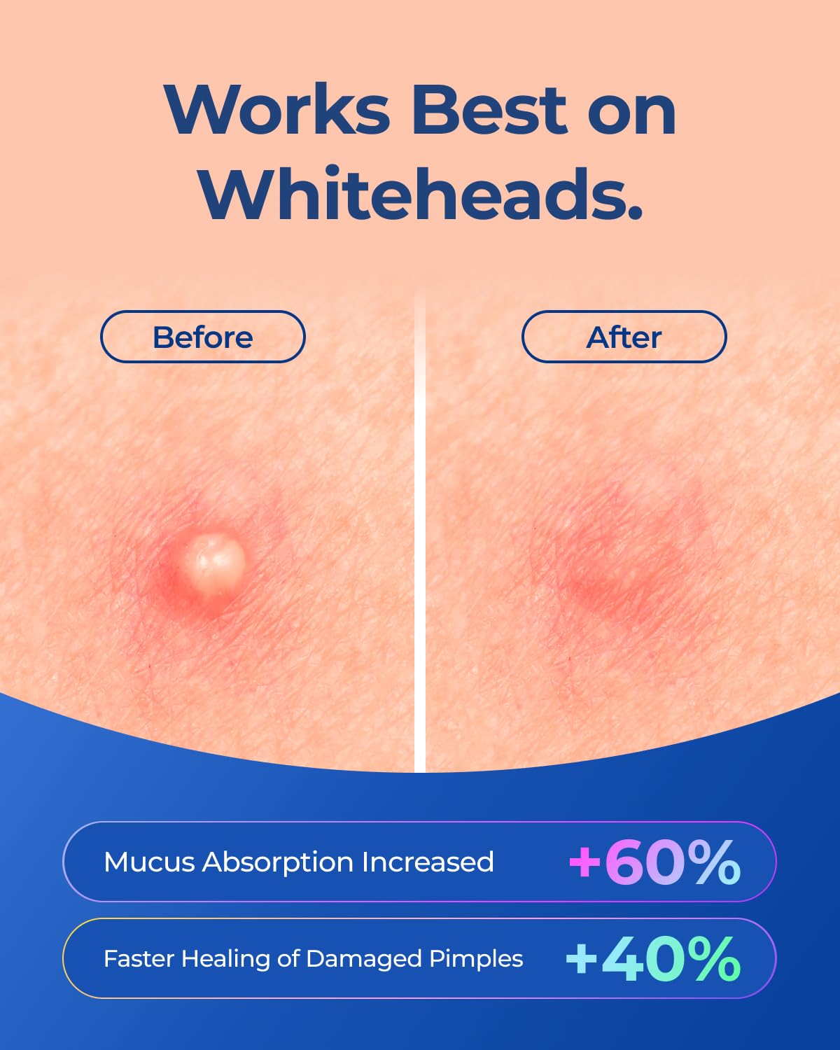 POINTMASS Star Pimple Patches for Face: Cute Acne Dots Hydrocolloid Stickers, Strong Absorption, 6 Colors, 312 Patches, Overnight Care