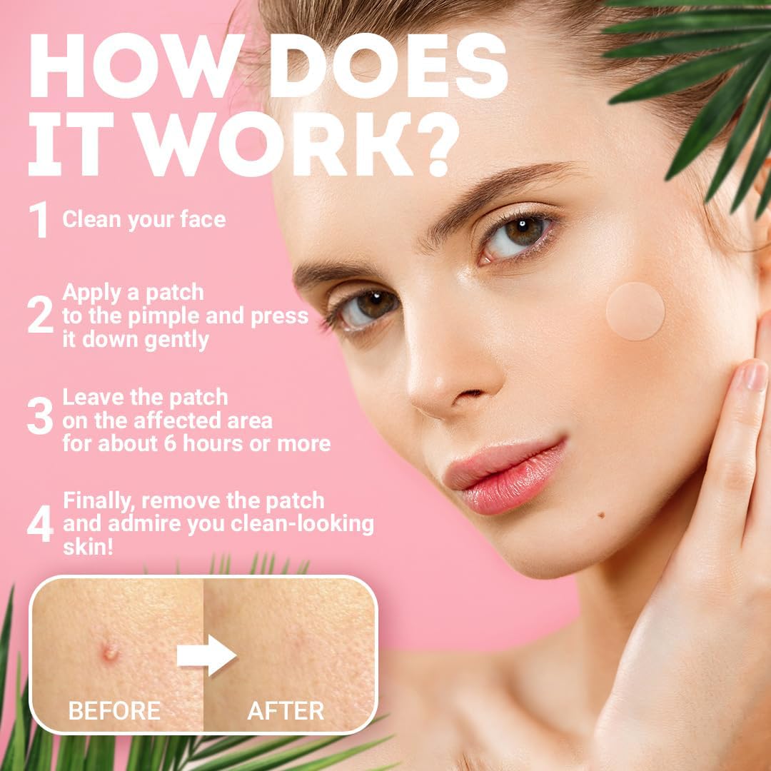 PUREVACY Acne Pimple Patch 3 Sizes. 120 Pack Clear Zit Patches for Face, Body. Thin Acne Patch Zit Dots with Tea Tree Oil, Calendula Oil. Absorbing Hydrocolloid Acne Patches, Blemish patches