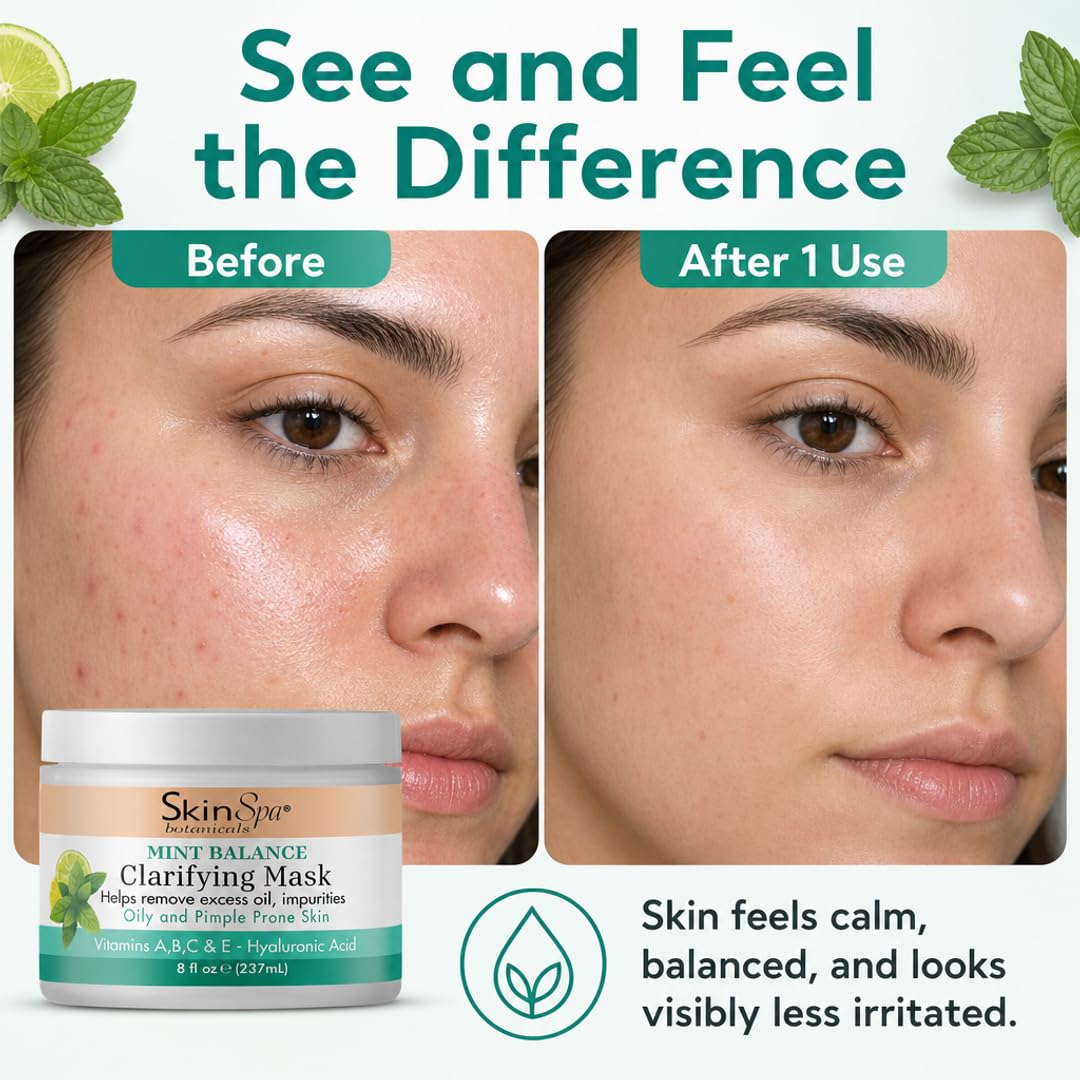 SkinSpa Face Mask - Acne Control Mint Julep Masque with Hyaluronic Acid, Vitamin B & E - Lock In Moisture, Cleanse & Refresh Oily, Pimple-Prone Skin - 8 oz